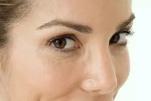 Castellano - Eyelid Surgery