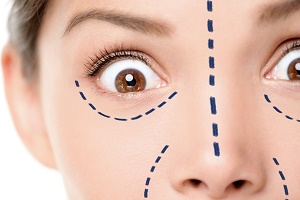 5 Fascinating Facts about Popular Cosmetic Procedures