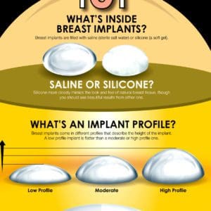 breast implants infographic