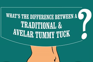 Traditional vs Avelar Tummy Tuck: What's the Difference? [Infographic]