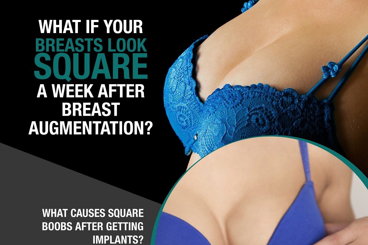 What If Your Breasts Look Square A Week After Breast Augmentation [Infographic]