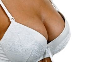 Breast Implants - Castellano March 2021