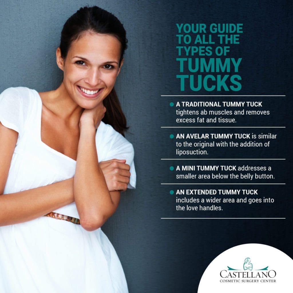 Your Guide To All The Types of Tummy Tucks [Infographic]