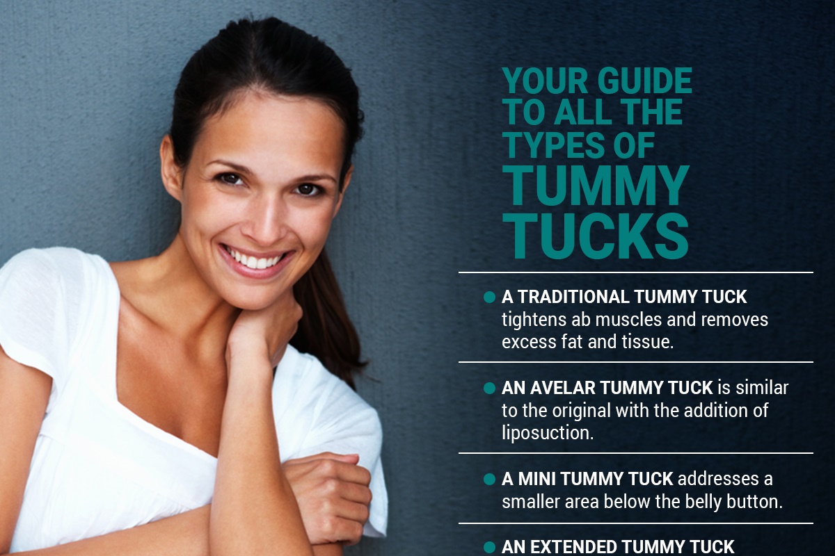 Your Guide To All The Types of Tummy Tucks [Infographic]