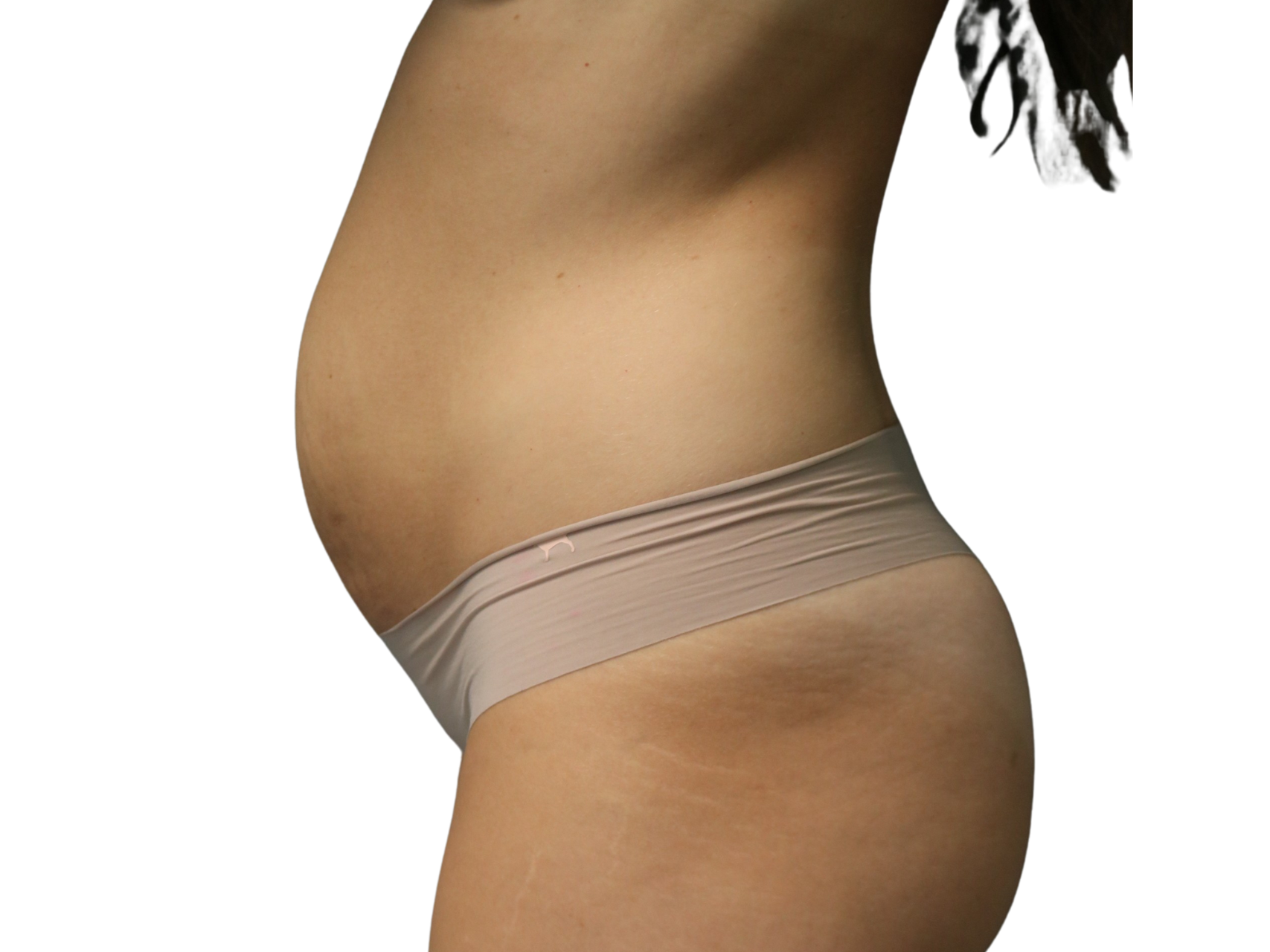 Tummy Tuck Patient Photo - Case 18920 - before view-