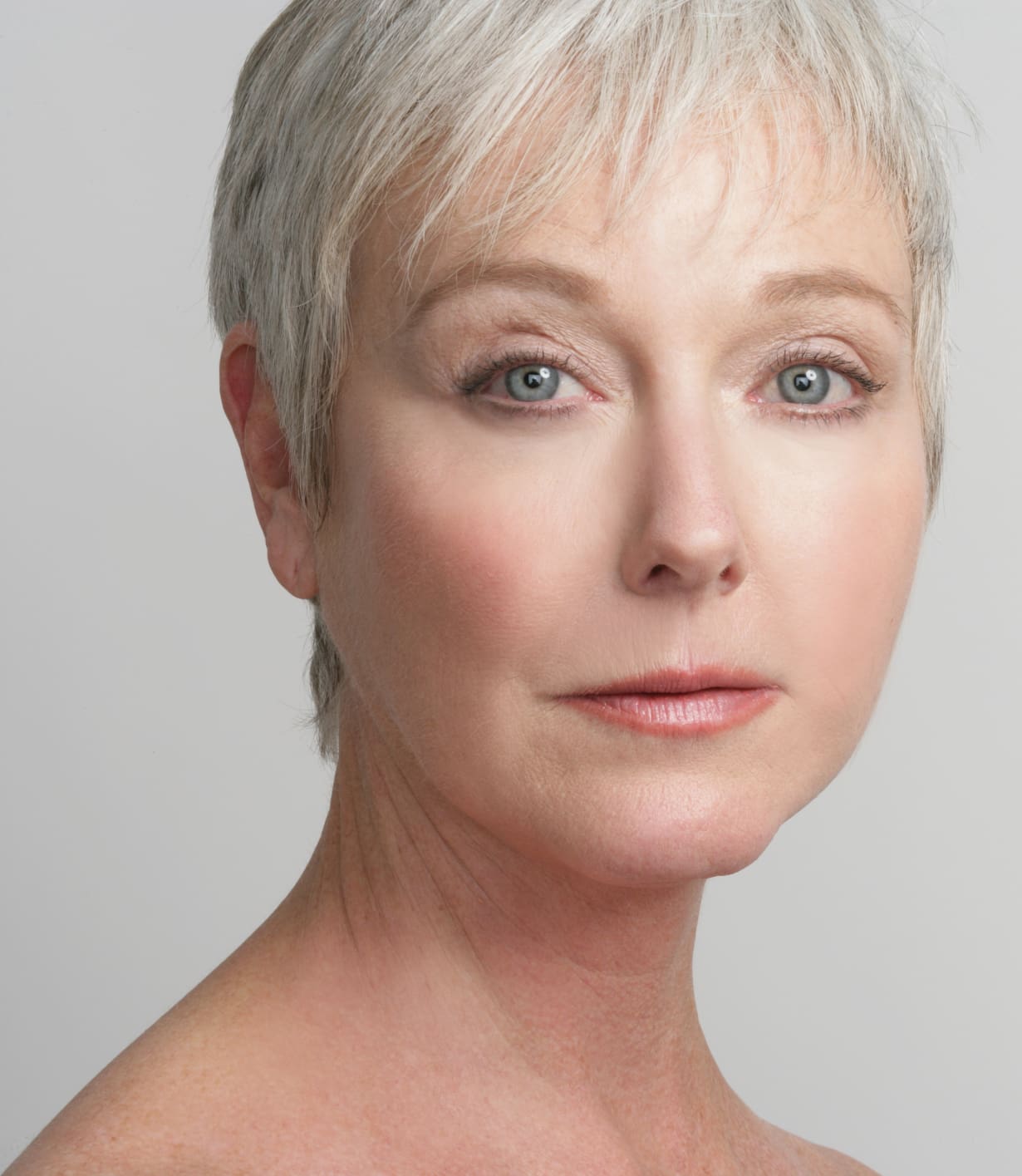 eyelid surgery model eyelid surgery model