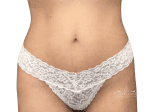 Tummy Tuck - Case 22396 - After